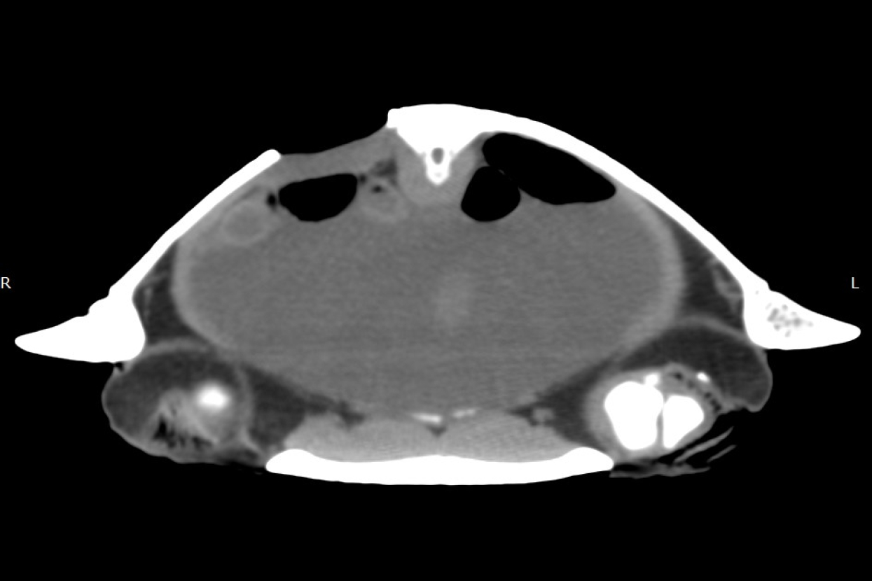 CT scan